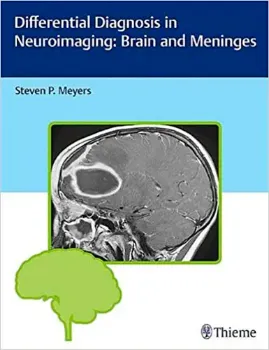 Imagem de Differential Diagnosis in Neuroimaging: Brain and Meninges