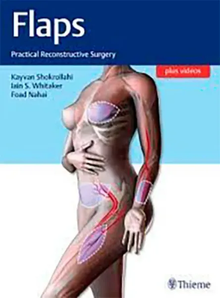 Imagem de Flaps: Practical Reconstructive Surgery