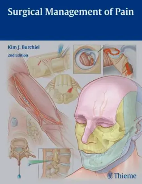 Imagem de Surgical Management of Pain