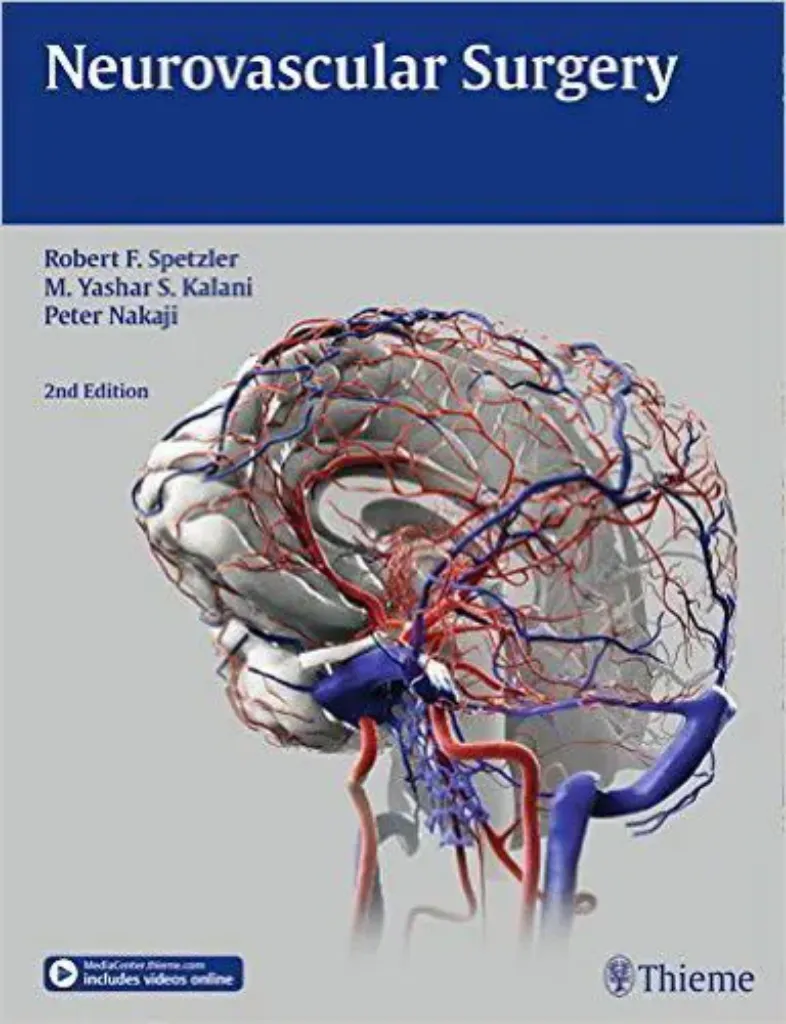 Imagem de Neurovascular Surgery