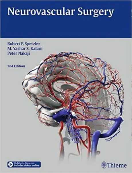 Imagem de Neurovascular Surgery