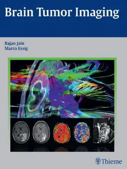 Picture of Book Brain Tumor Imaging