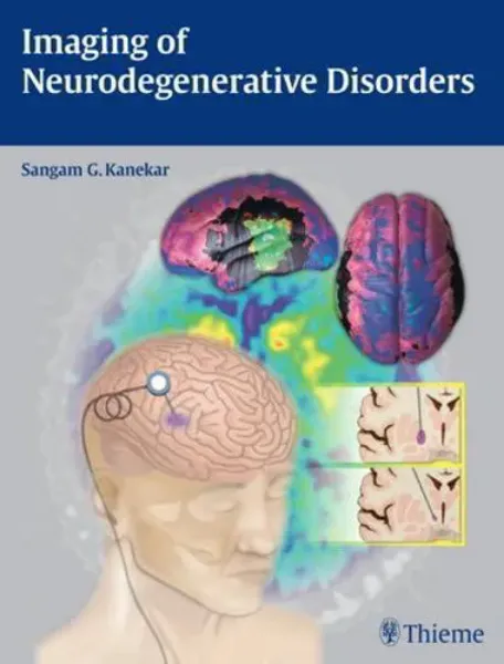 Imagem de Imaging of Neurodegenerative Disorders