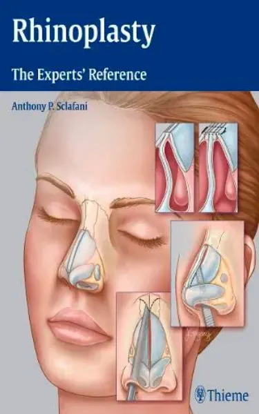 Imagem de Rhinoplasty: The Experts' Reference