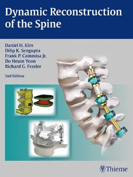 Picture of Book Dynamic Reconstruction of the Spine