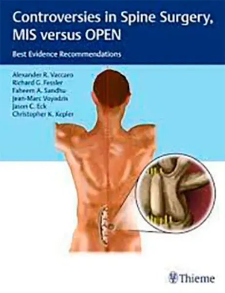 Imagem de Controversies in Spine Surgery, MIS versus OPEN: Best Evidence Recommendations