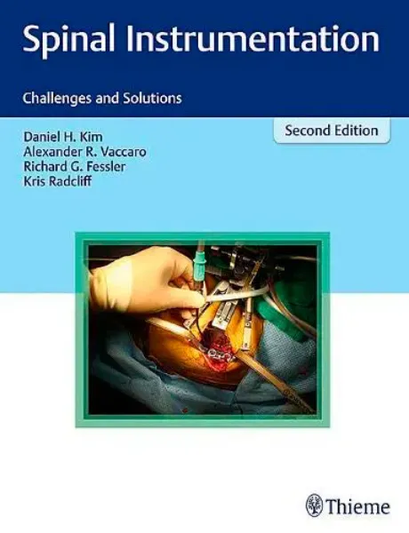 Imagem de Spinal Instrumentation: Challenges and Solutions