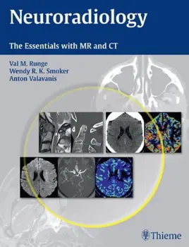 Imagem de Neuroradiology the Essentials with MRI and CT