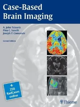Picture of Book Case-Based Brain Imaging