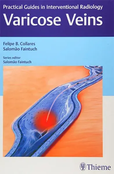 Imagem de Varicose Veins: Practical Guides in Interventional Radiology