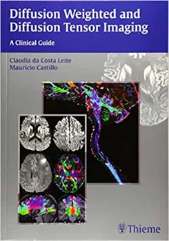 Imagem de Diffusion Weighted and Diffusion Tensor Imaging: A Clinical Guide
