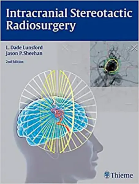Imagem de Intracranial Stereotactic Radiosurgery