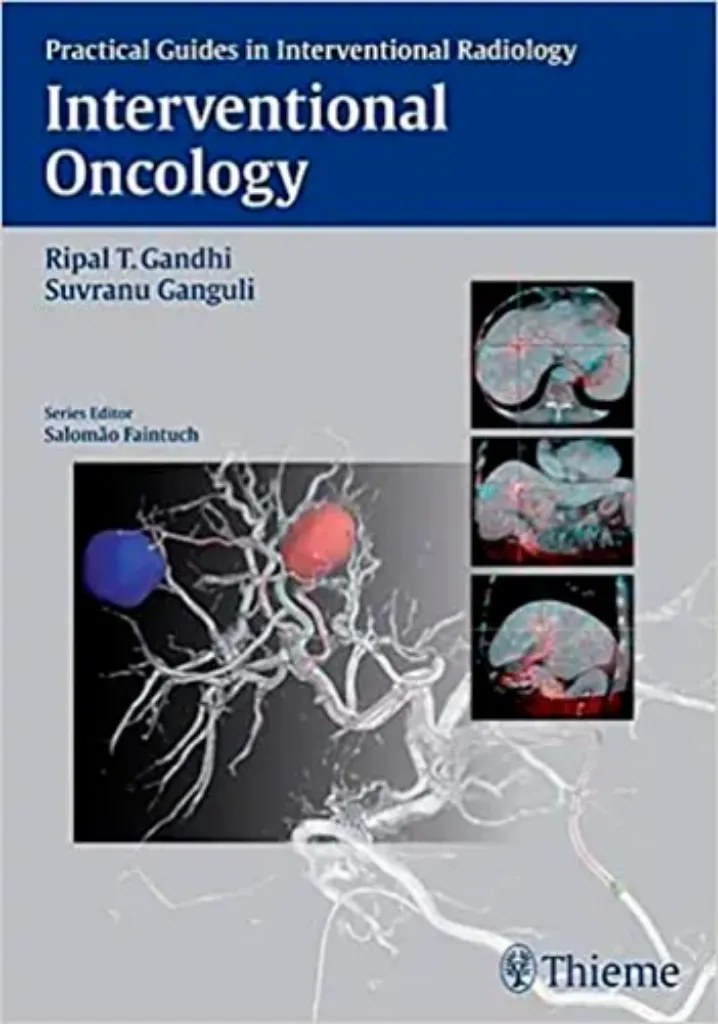 Imagem de Interventional Oncology