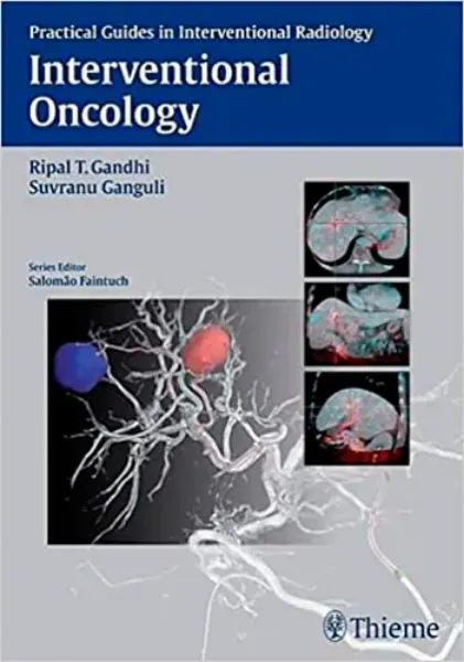 Imagem de Interventional Oncology