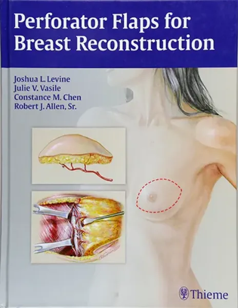 Imagem de Perforator Flaps for Breast Reconstruction