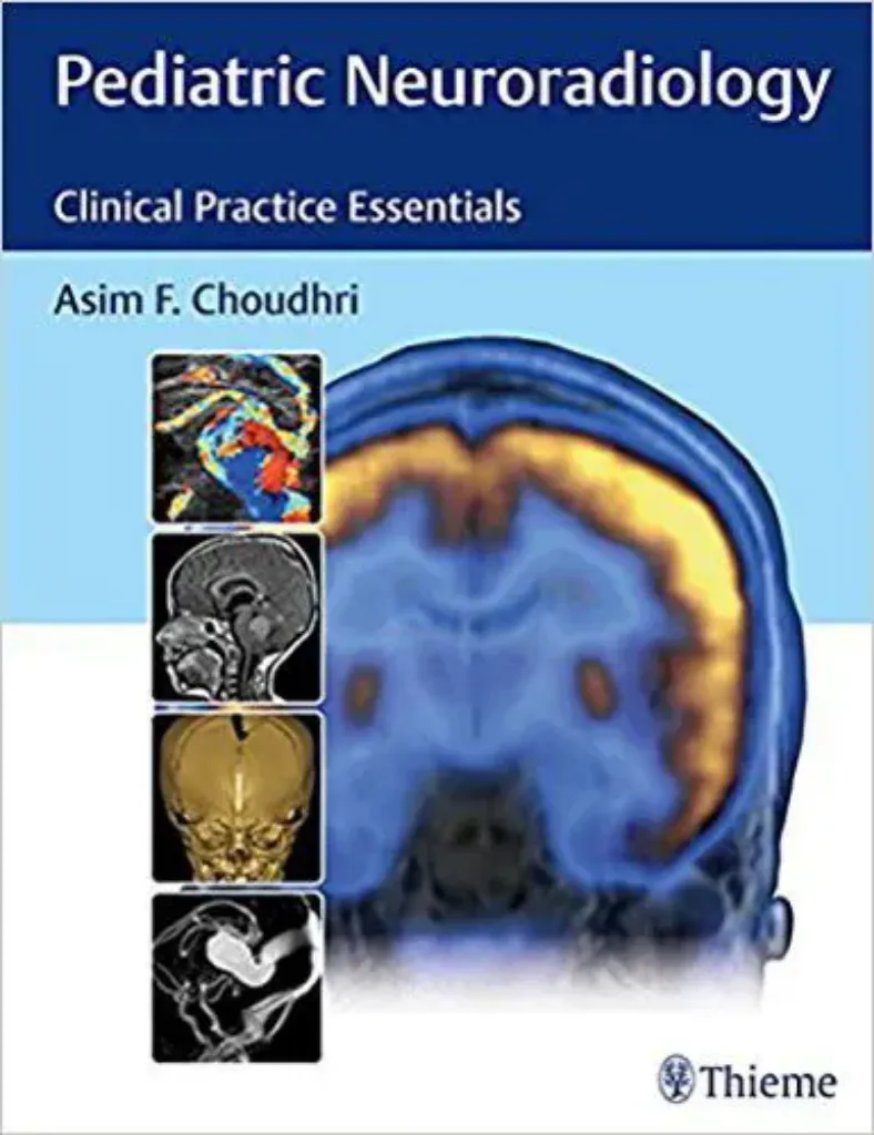Imagem de Pediatric Neuroradiology: The Essentials