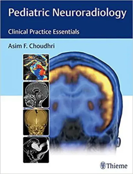 Imagem de Pediatric Neuroradiology: The Essentials