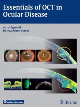 Picture of Book Essentials OCT in Ocular Disease
