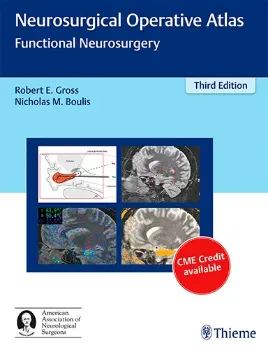 Imagem de Neurosurgical Operative Atlas: Functional Neurosurgery