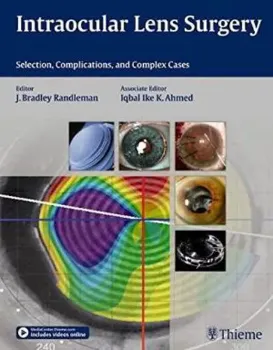 Imagem de Intraocular Lens Surgery: Selection, Complications, and Complex Cases