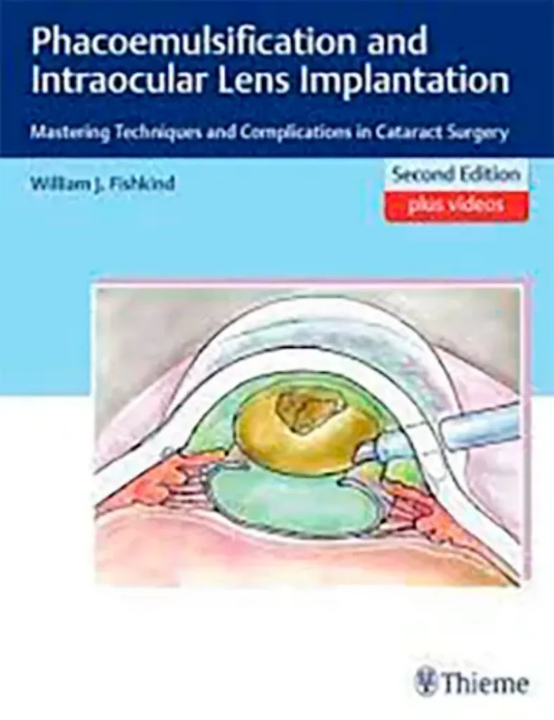 Imagem de Phacoemulsification and Intraocular Lens Implantation: Mastering Techniques and Complications in Cataract Surgery