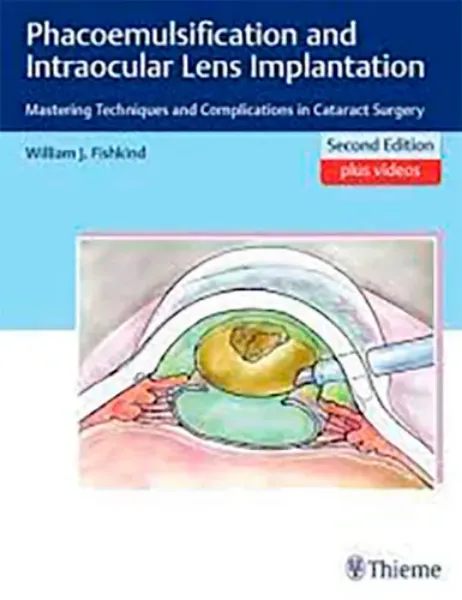 Imagem de Phacoemulsification and Intraocular Lens Implantation: Mastering Techniques and Complications in Cataract Surgery