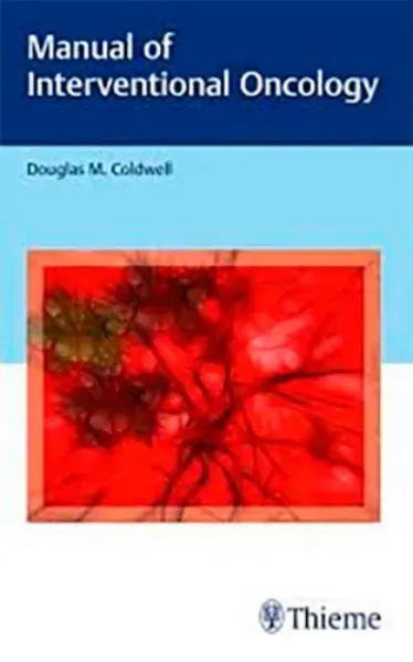 Imagem de Manual of Interventional Oncology