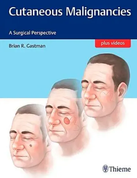Imagem de Cutaneous Malignancies: A Surgical Perspective