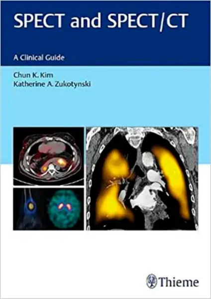 Imagem de SPECT and SPECT/CT: A Clinical Guide