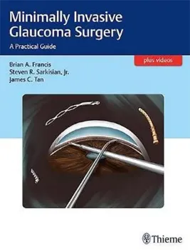 Picture of Book Minimally Invasive Glaucoma Surgery: A Practical Guide