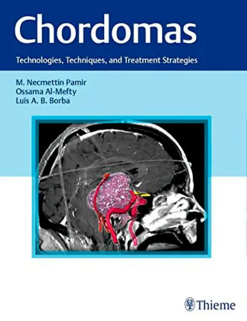 Imagem de Chordomas: Technologies, Techniques and Treatment Strategies