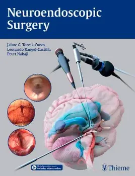 Imagem de Neuroendoscopic Surgery