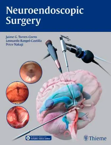 Imagem de Neuroendoscopic Surgery