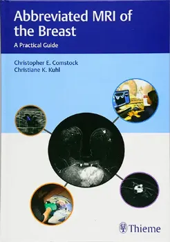 Picture of Book Abbreviated MRI of the Breast: A Practical Guide