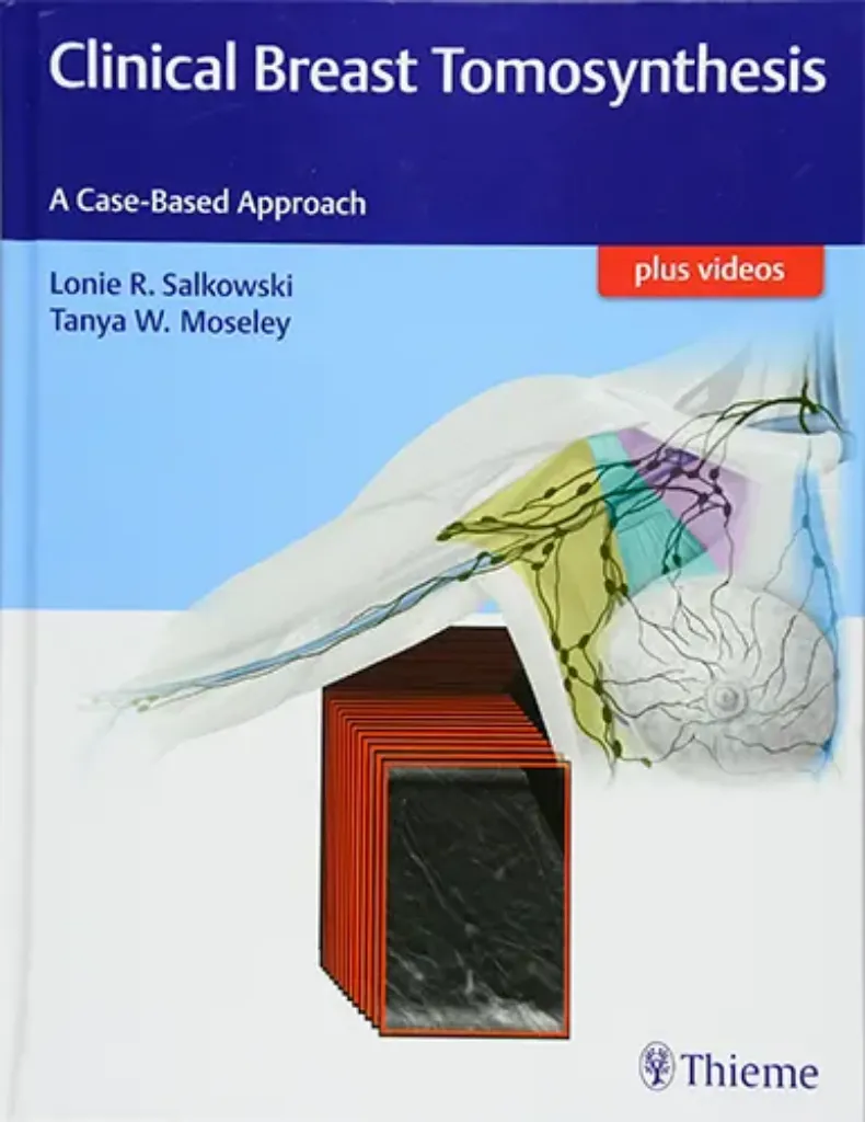 Imagem de Clinical Breast Tomosynthesis: A Case-Based Approach