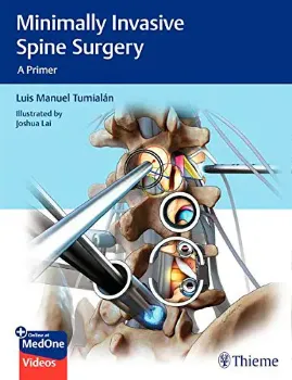 Imagem de Minimally Invasive Spine Surgery: A Primer