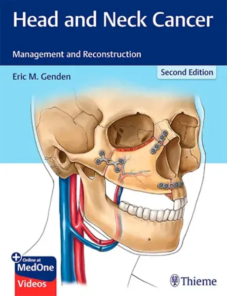 Imagem de Head and Neck Cancer: Management and Reconstruction