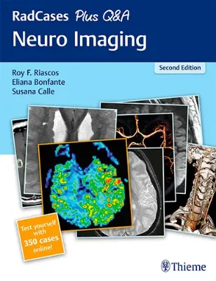Picture of Book RadCases Plus Q&A Neuro Imaging
