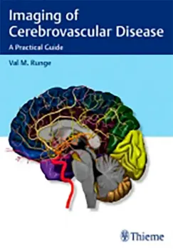 Imagem de Imaging of Cerebrovascular Disease: A Practical Guide