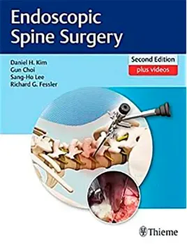 Imagem de Endoscopic Spine Surgery