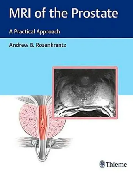 Imagem de MRI of the Prostate: A Practical Approach