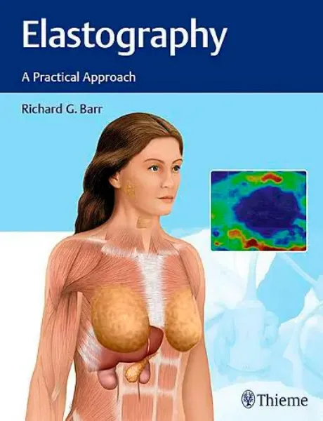Imagem de Elastography: A Practical Approach