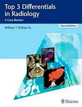 Imagem de Top 3 Differentials in Radiology: A Case Review