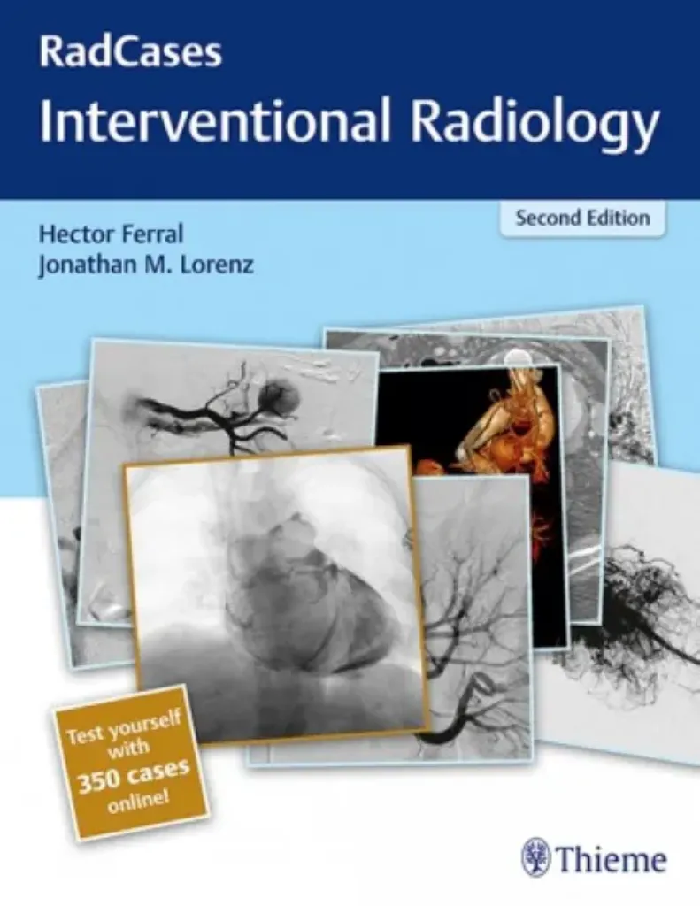 Imagem de Radcases Interventional Radiology