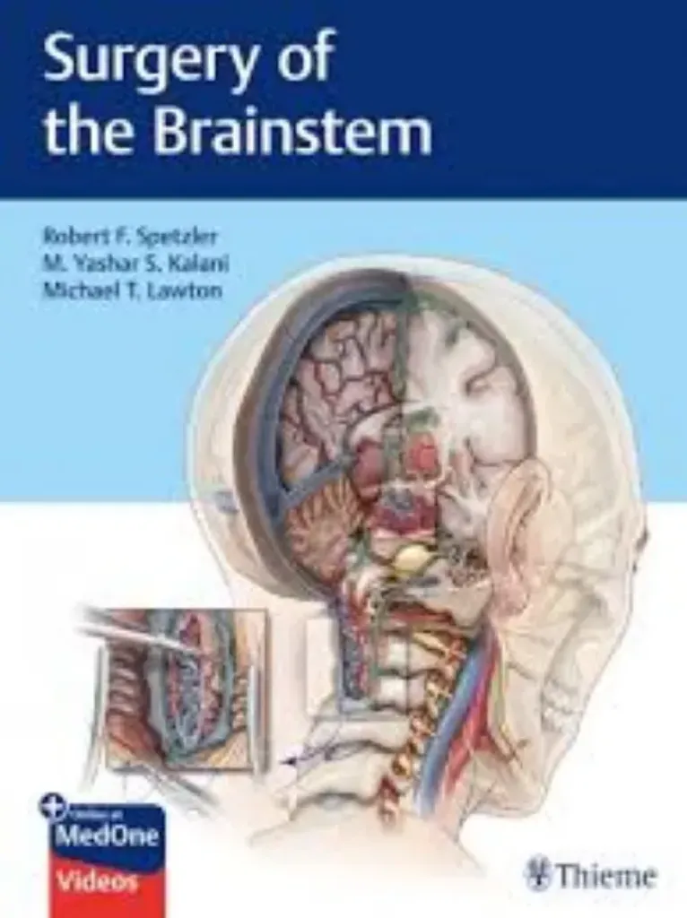 Imagem de Surgery of the Brainstem