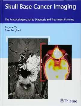 Picture of Book Skull Base Cancer Imaging: The Practical Approach to Diagnosis and Treatment Planning