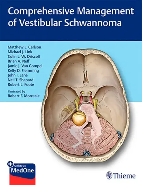Imagem de Comprehensive Management of Vestibular Schwannoma