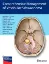 Imagem de Comprehensive Management of Vestibular Schwannoma