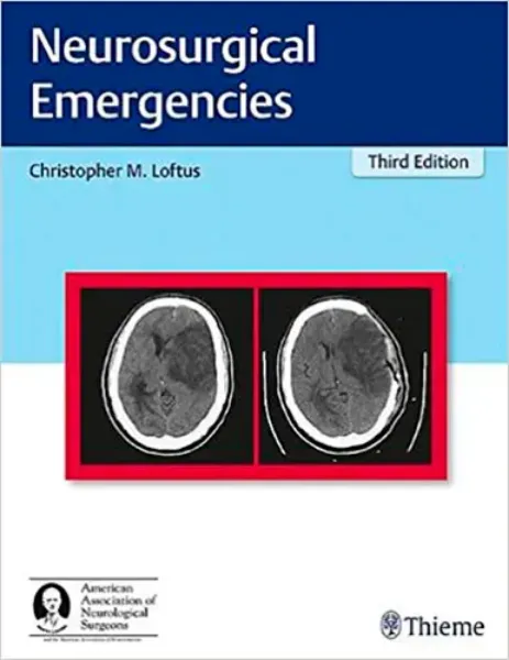 Imagem de Neurosurgical Emergencies