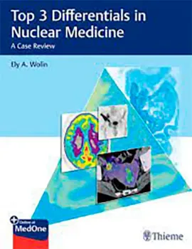 Imagem de Top 3 Differentials in Nuclear Medicine: A Case Review